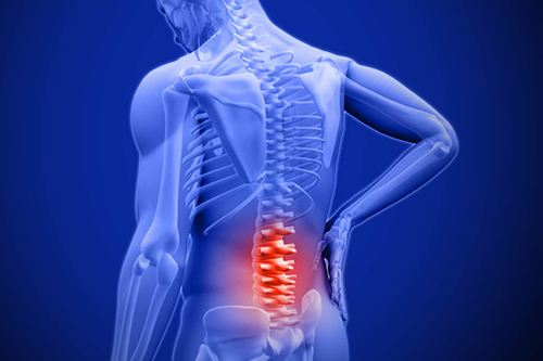 Lấy nguyên nhân làm phương pháp điều trị bệnh đau lưng hiệu quả