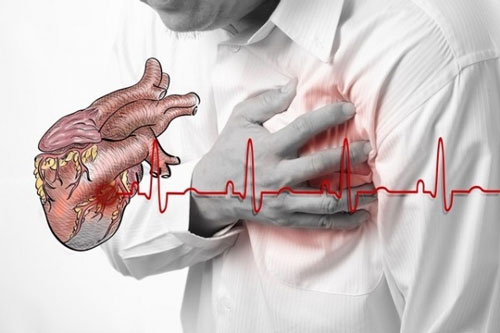 Nguyên nhân nào gây ra bệnh suy tim?
