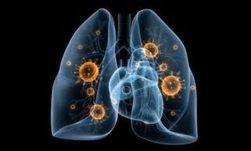 Chuyên gia Điều dưỡng cùng bạn phòng ngừa bệnh bụi phổi