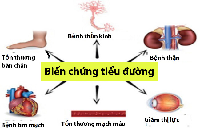 Sớm nhận biết bệnh tiểu đường qua 5 triệu chứng lạ Sớm nhận biết bệnh tiểu đường qua 5 triệu chứng lạ